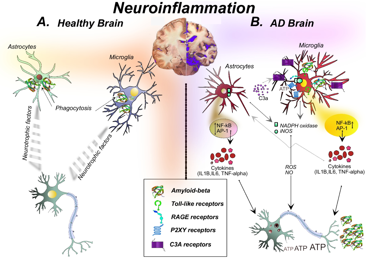 Mikroglia ve astrositlerin neden olduğu nöroinflamasyonun basamakları
